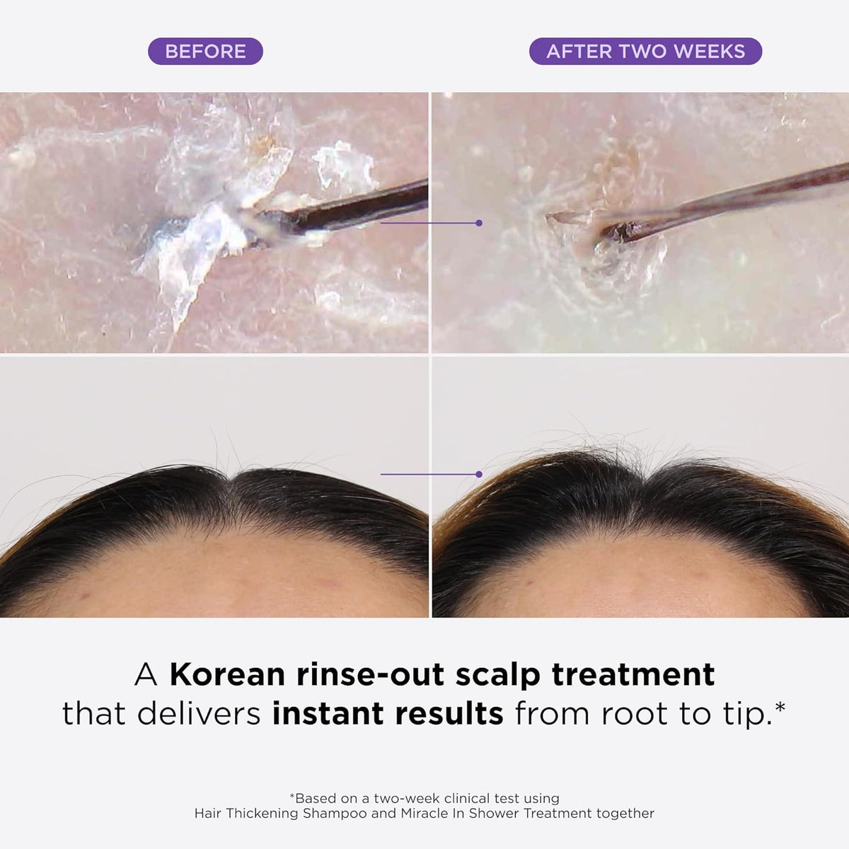 Clinical Hair Rebirth: Stop Thinning & Regrow Thicker Hair in 4 Weeks