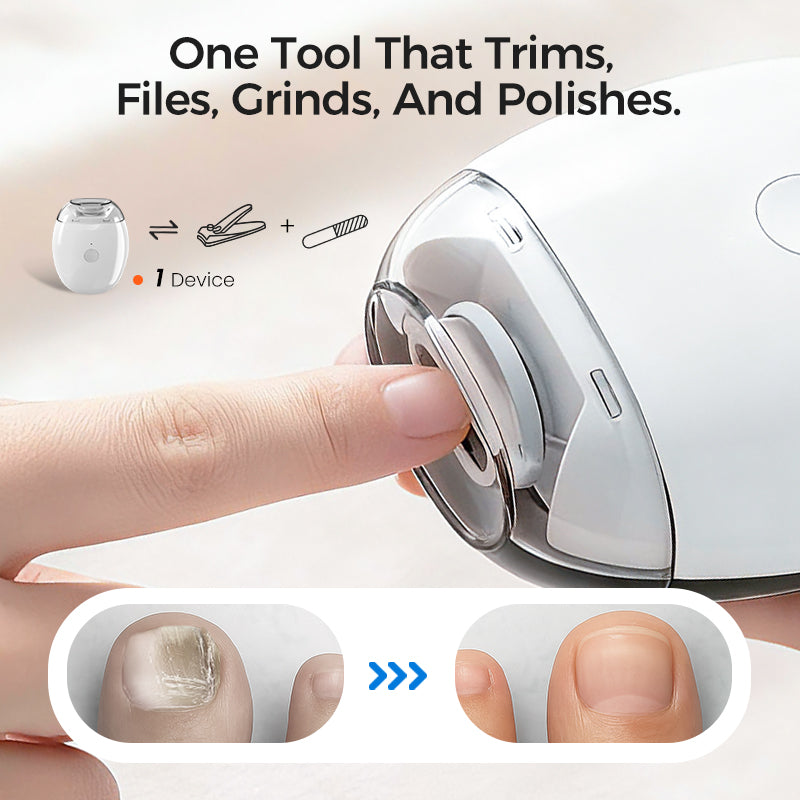 ⚡50K+ SOLD!🔥Universal Automatic Fingernail Grinder