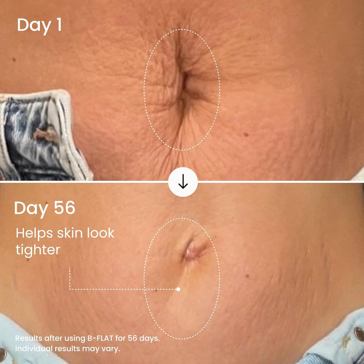 Visibly Firm & Smooth Your Belly