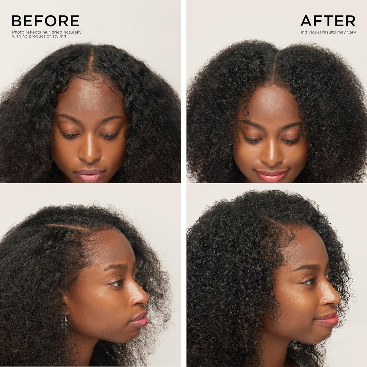 Clinical Hair Rebirth: Stop Thinning & Regrow Thicker Hair in 4 Weeks