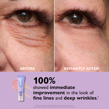 Eye Bag Instant Eraser, Tightens, Firms, & Blurs Wrinkles