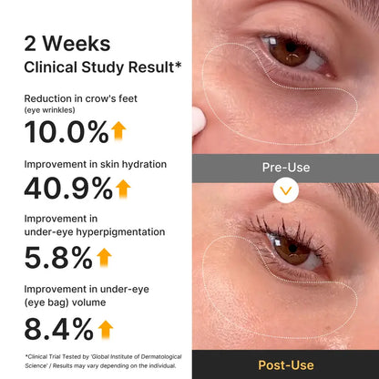 Kojic Acid & Turmeric Vita Jelly Eye Patch for Dark Circles & Depuffing | 2 Pack per Set
