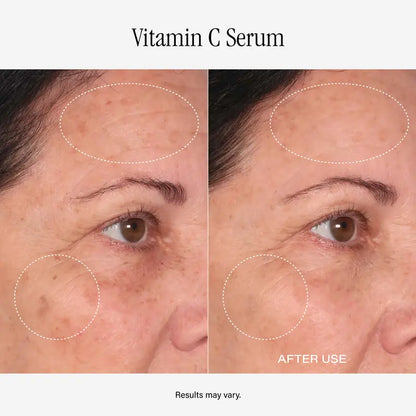 SKINN Divine Elixir Vitamin C Serums – Two-Bottle Set