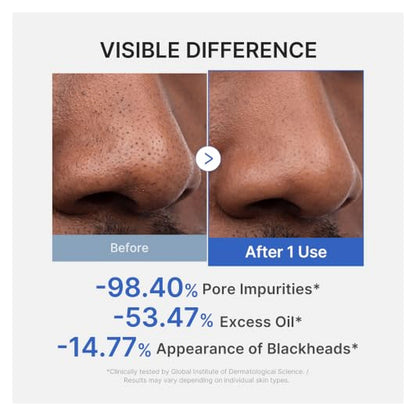 medicube Zero Pore Blackhead Mud Mask - 100g